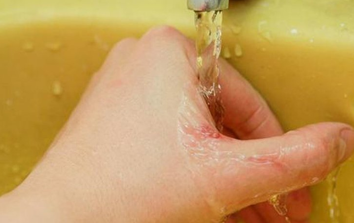 Tay người đang được xả nước dưới vòi trong bồn rửa màu vàng.