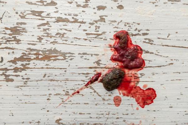 Why Does My Dog Vomit Blood? - Causes of Throwing Up Blood